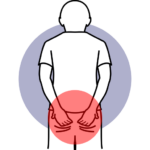 douleur périnée